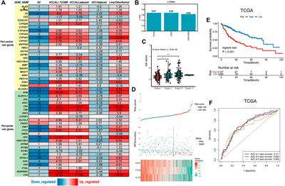 Significance of Liver Zonation in Hepatocellular Carcinoma